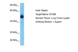 YANK2 Rabbit anti-Human, Polyclonal, Novus Biologicals 100 &mu;g | Buy Online | Novus Biologicals | Fisher Scientific
